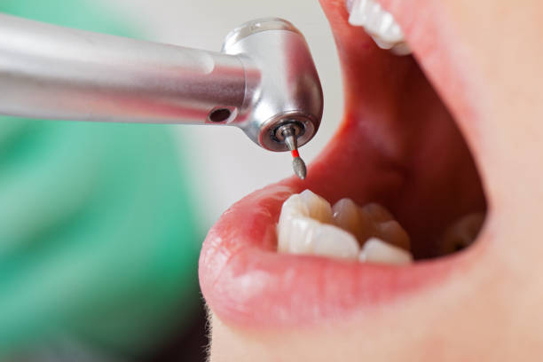 Best Broken or Cracked Tooth Emergency Dentist in Lake Park, NC
